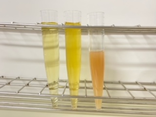 おしっこが教えてくれる事　～おや？おしっこが変カモ！？～