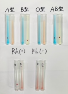 血液型検査🩸