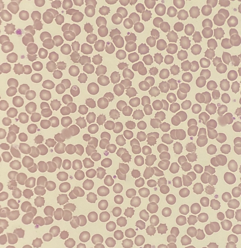 身体を守る小さな戦士たち　～Part１～