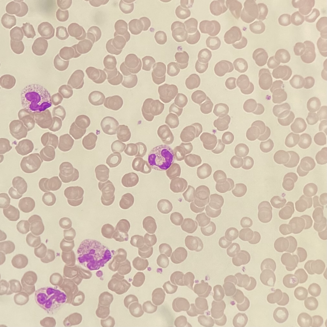 身体を守る小さな戦士たち　～Part2～