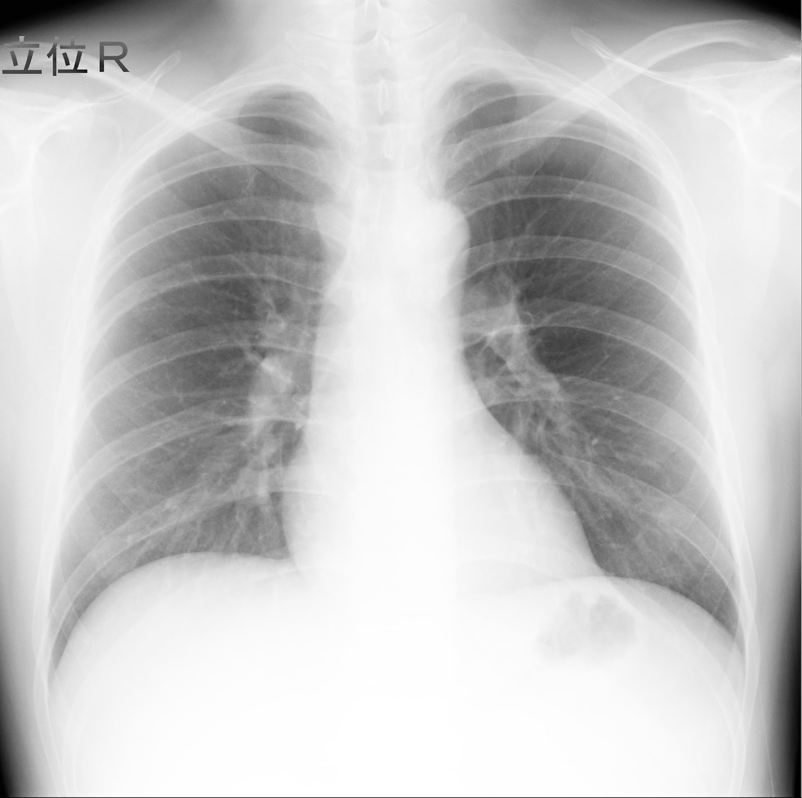 心臓の大きさを計ってみよう!