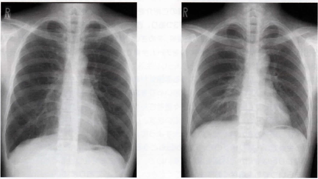 息を吸って～止めてくださ～い