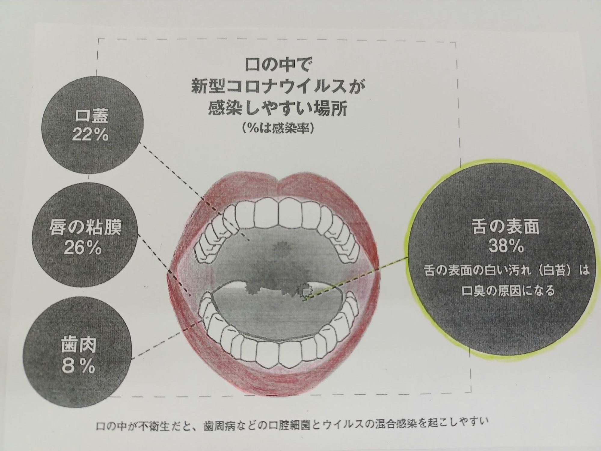歯と舌をキレイにしましょう✨担当:居宅