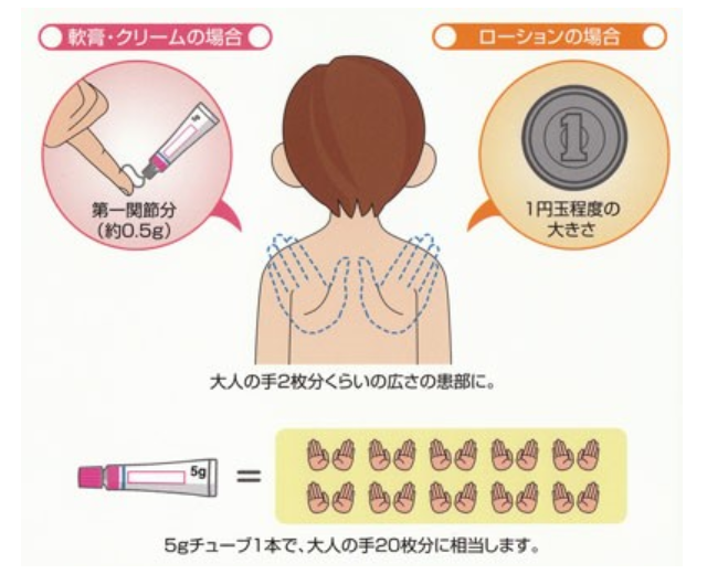 FTU（フィンガーチップユニット）💊担当:薬局